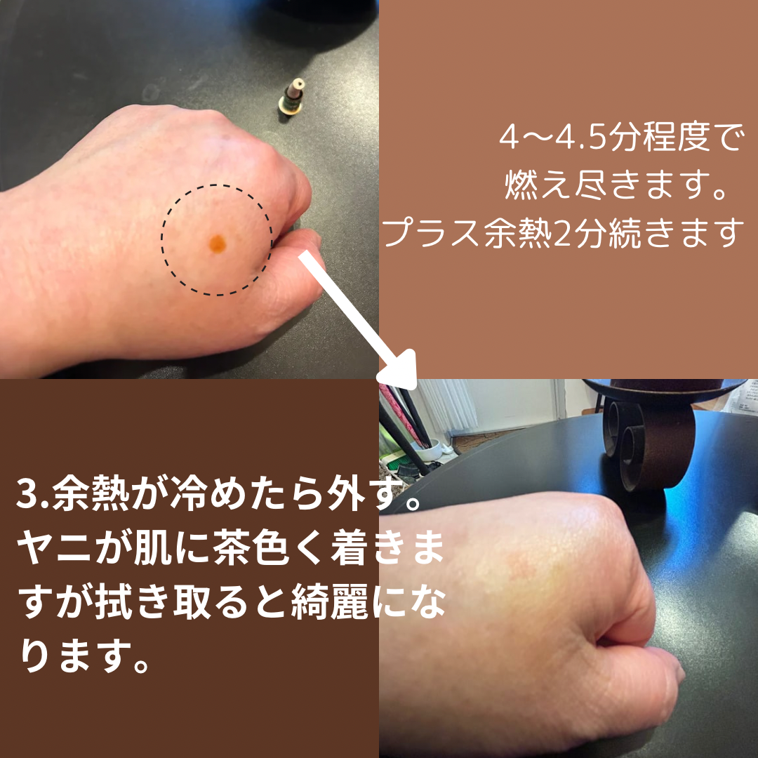 お灸100個/少し熱め+熱さ強め