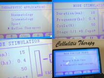 業務用痩身機 BIO CURVE スターヴァック エンダモロジー セルライト