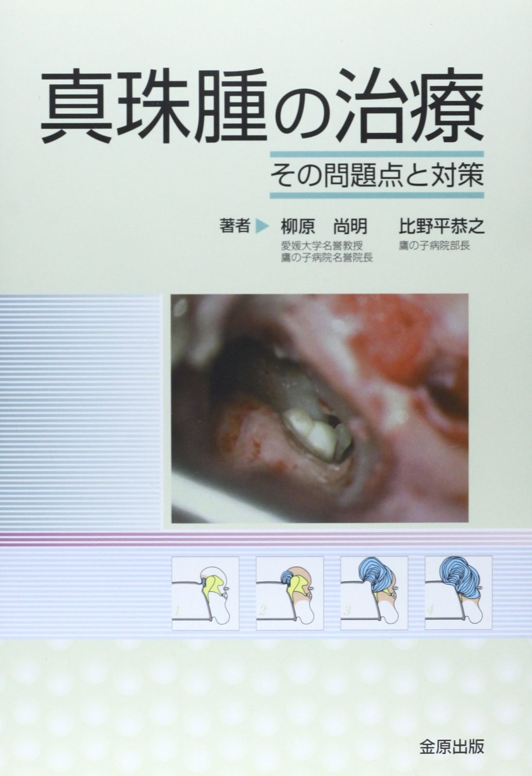 安い T*E様 カブ テレスコ化 19インチ