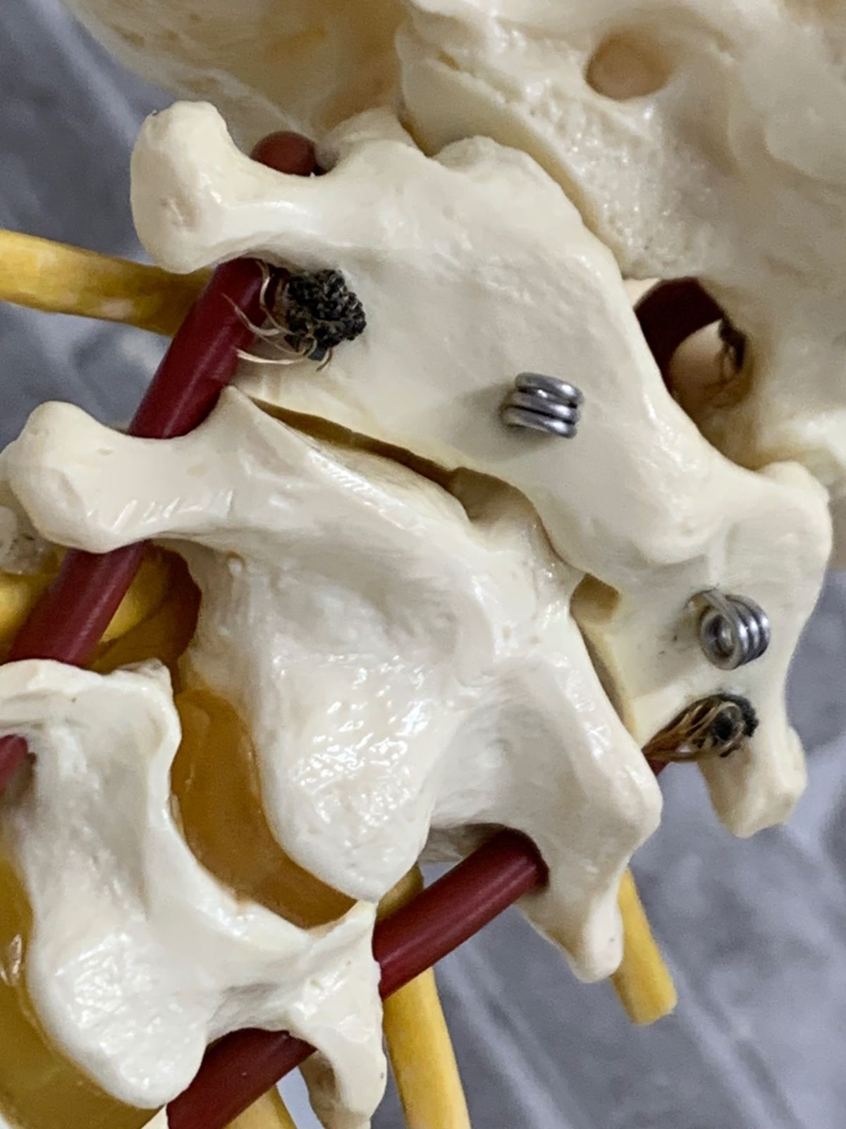 SOMSO ソムソ社 ベスト 人体模型 頸椎模型 SOMSO(ソムソ)社製 脊柱模型