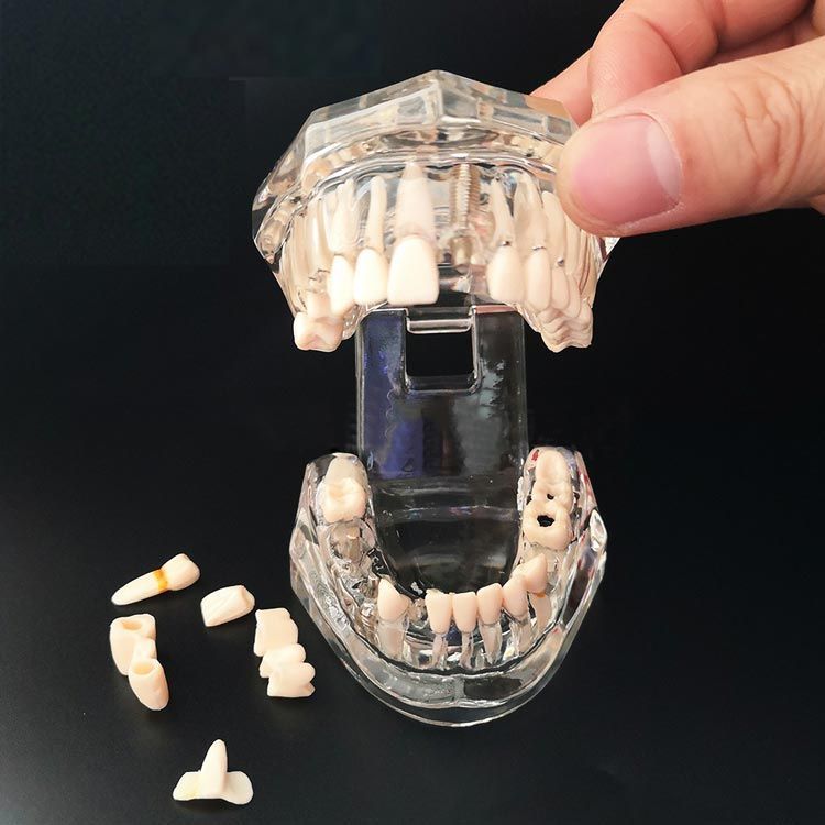 歯の構造模型 透視式 透明歯列発育模型 [PE-PDI003(P12P-100C)]