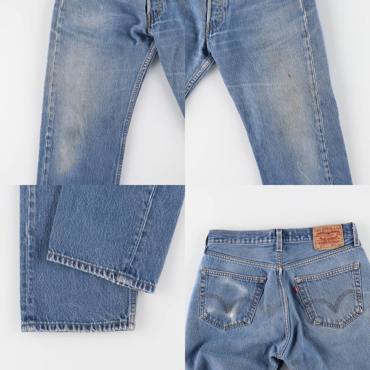 LEG BUTTON-FLY