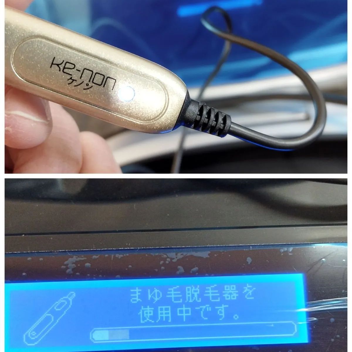 ケノン家庭用脱毛器 シャンパンゴールド ケノン 脱毛器 シャンパン