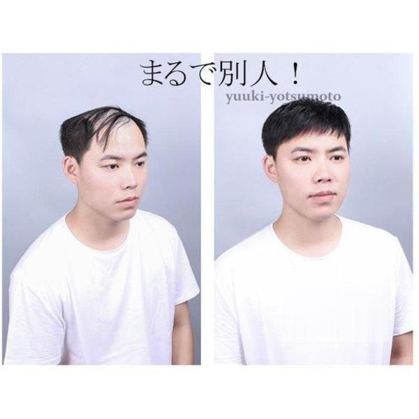 ウィッグ