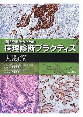 癌診療指針のための病理診断プラクティス 肺癌 癌診療指針のための病理診断プラクティス 肺癌 / 青笹 克之【総