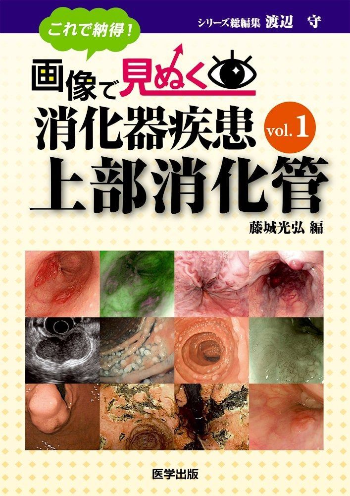 これで納得! 画像で見ぬく消化器疾患 vol.1 上部消化管