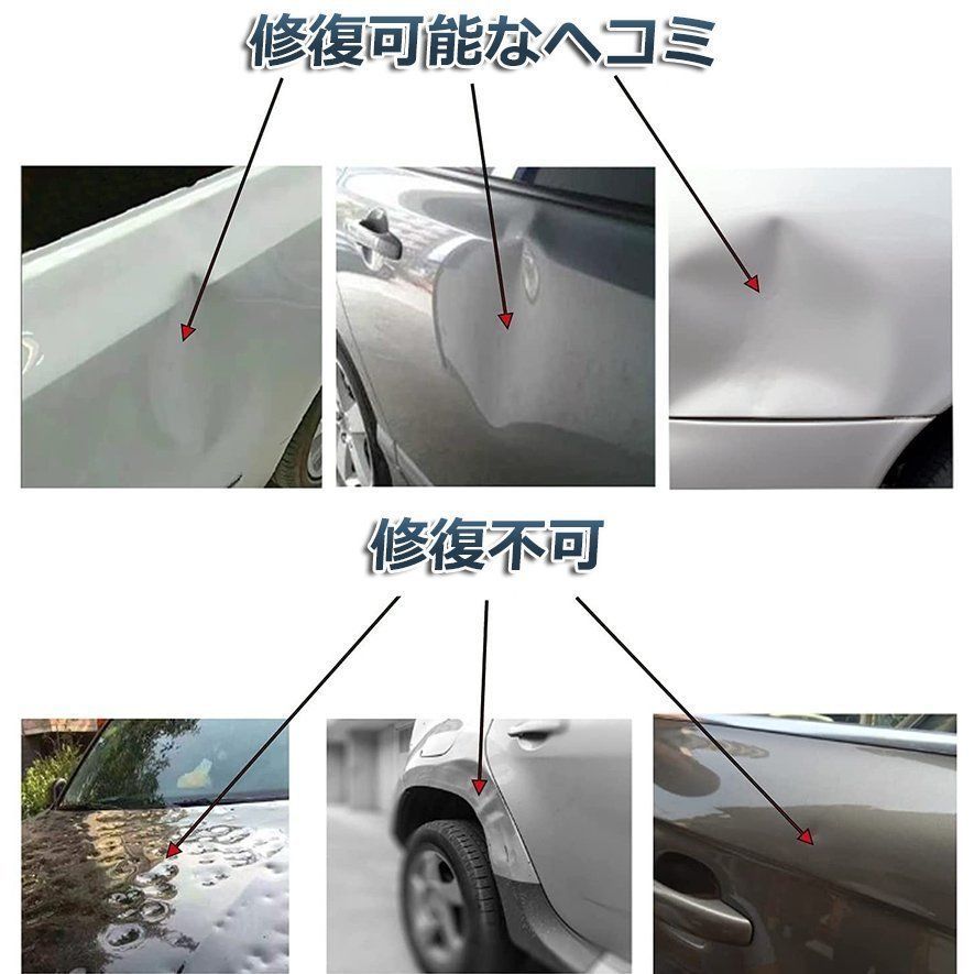 取っ手