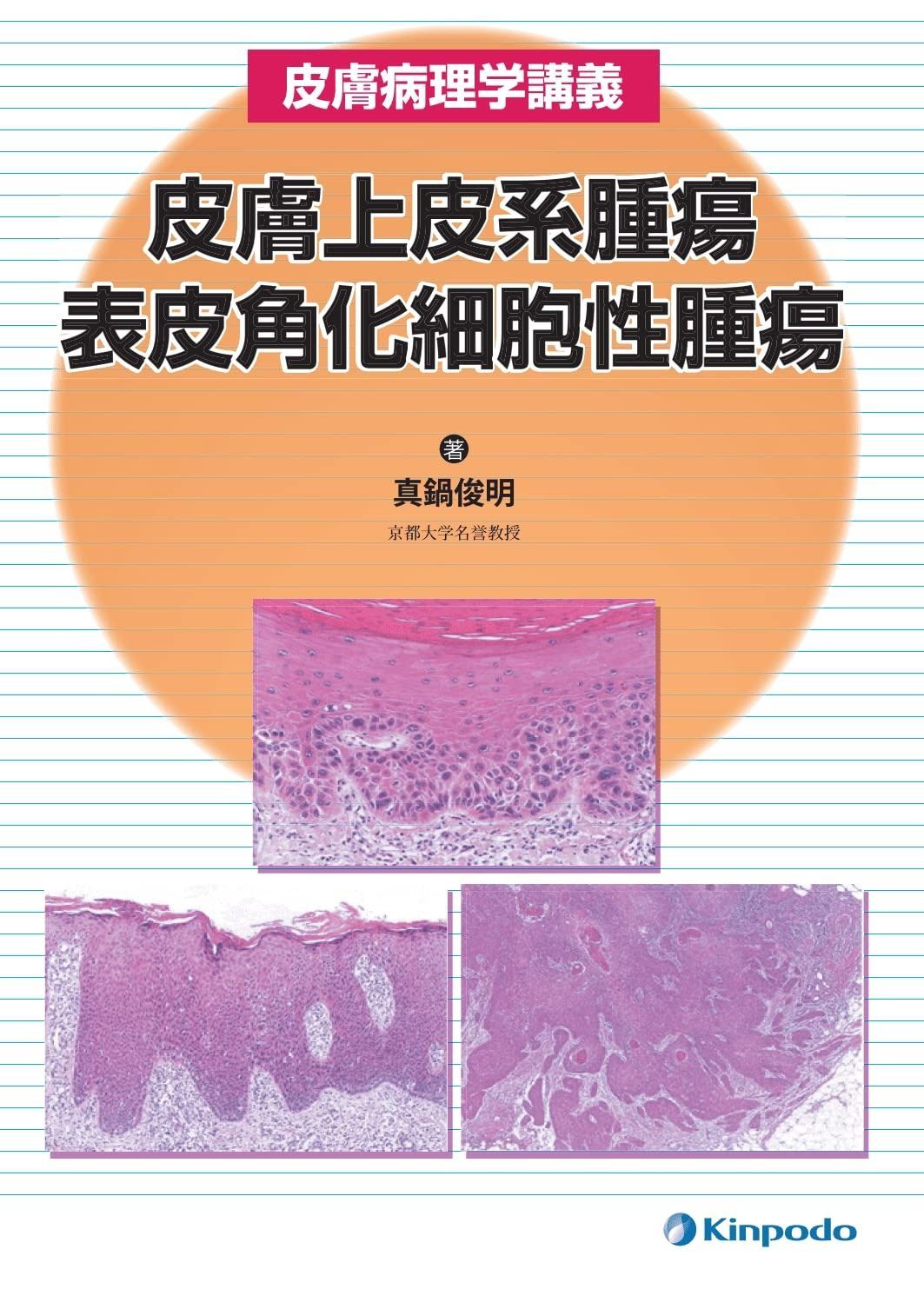 皮膚病理学講義 皮膚上皮系腫瘍 表皮角化細胞性腫瘍