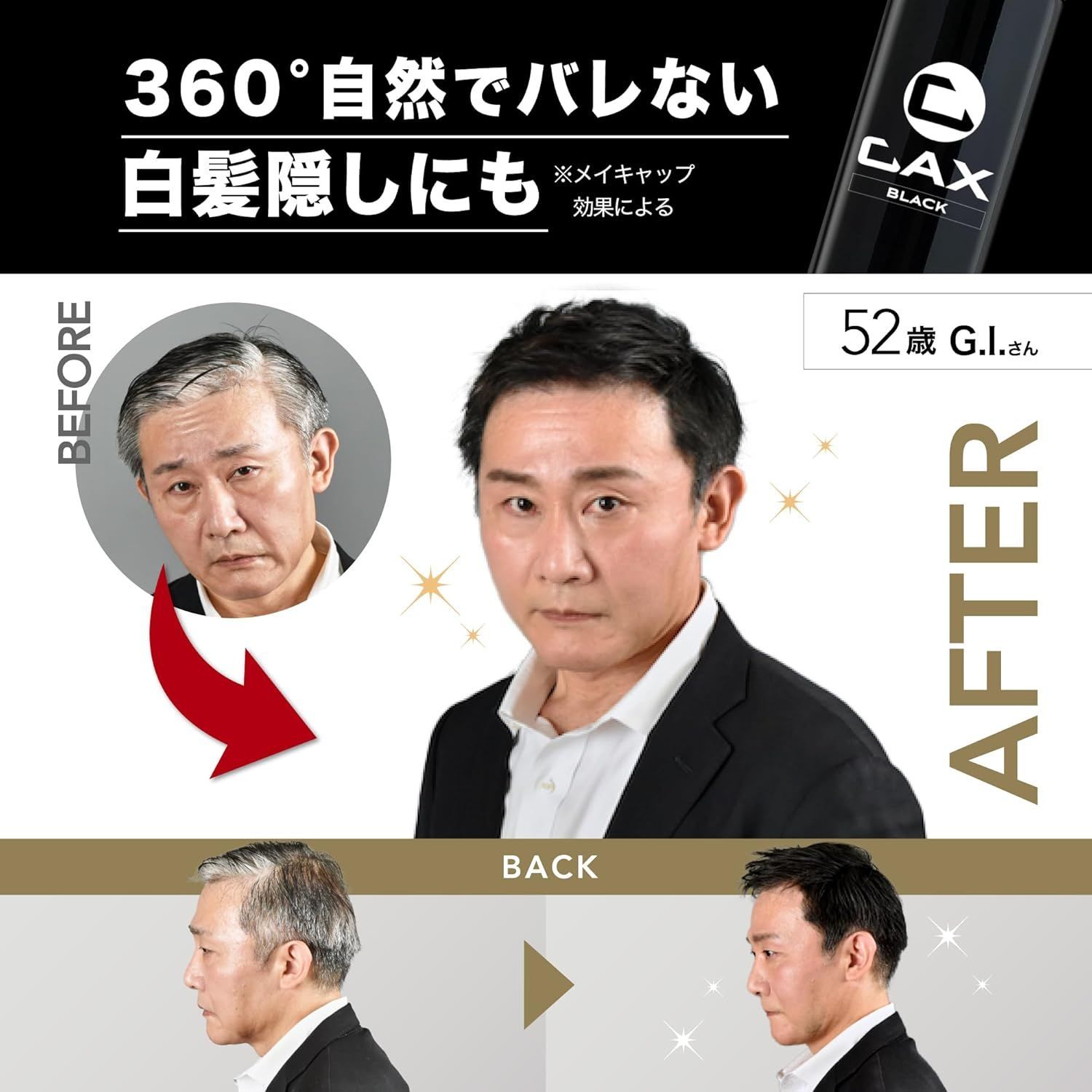 白髪 薄毛隠し