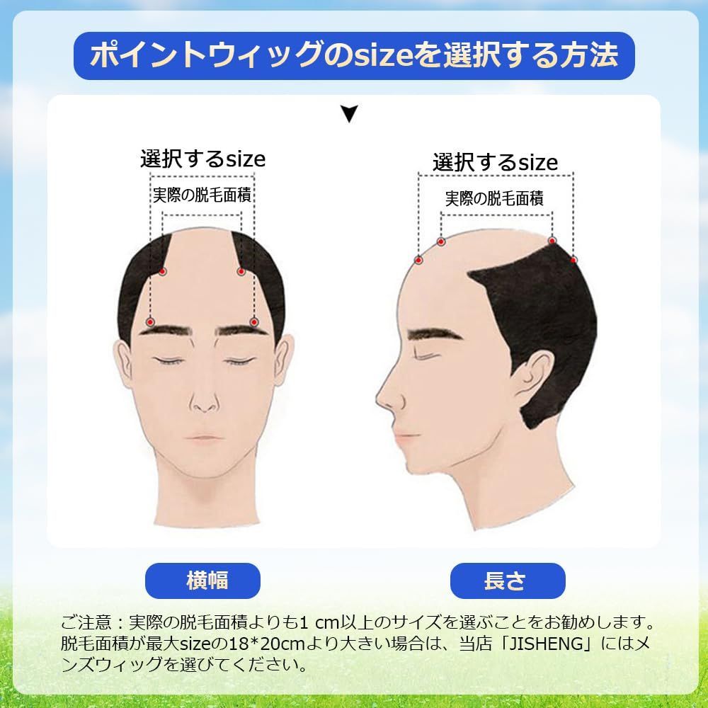 頭頂部
