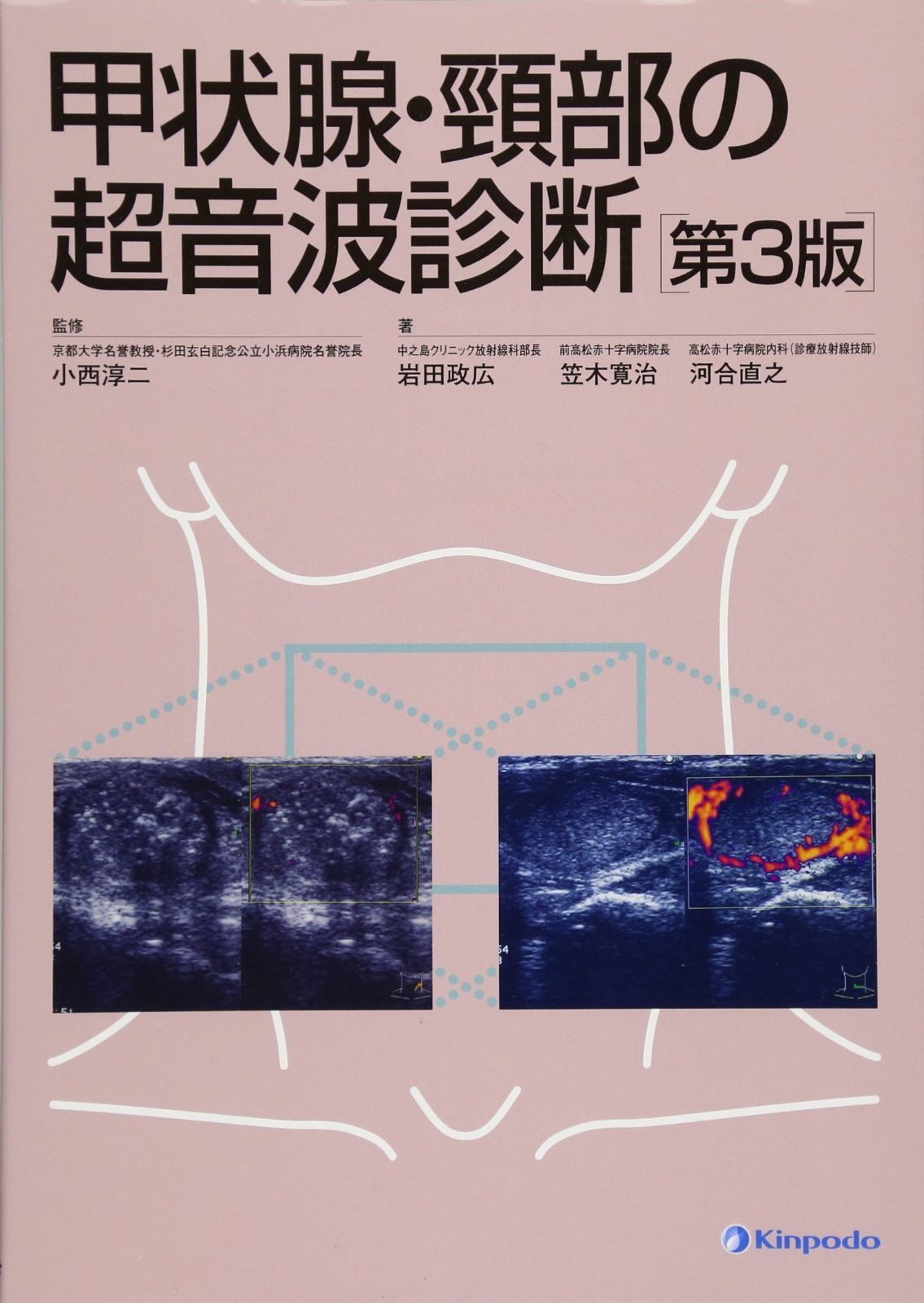 甲状腺・頚部の超音波診断