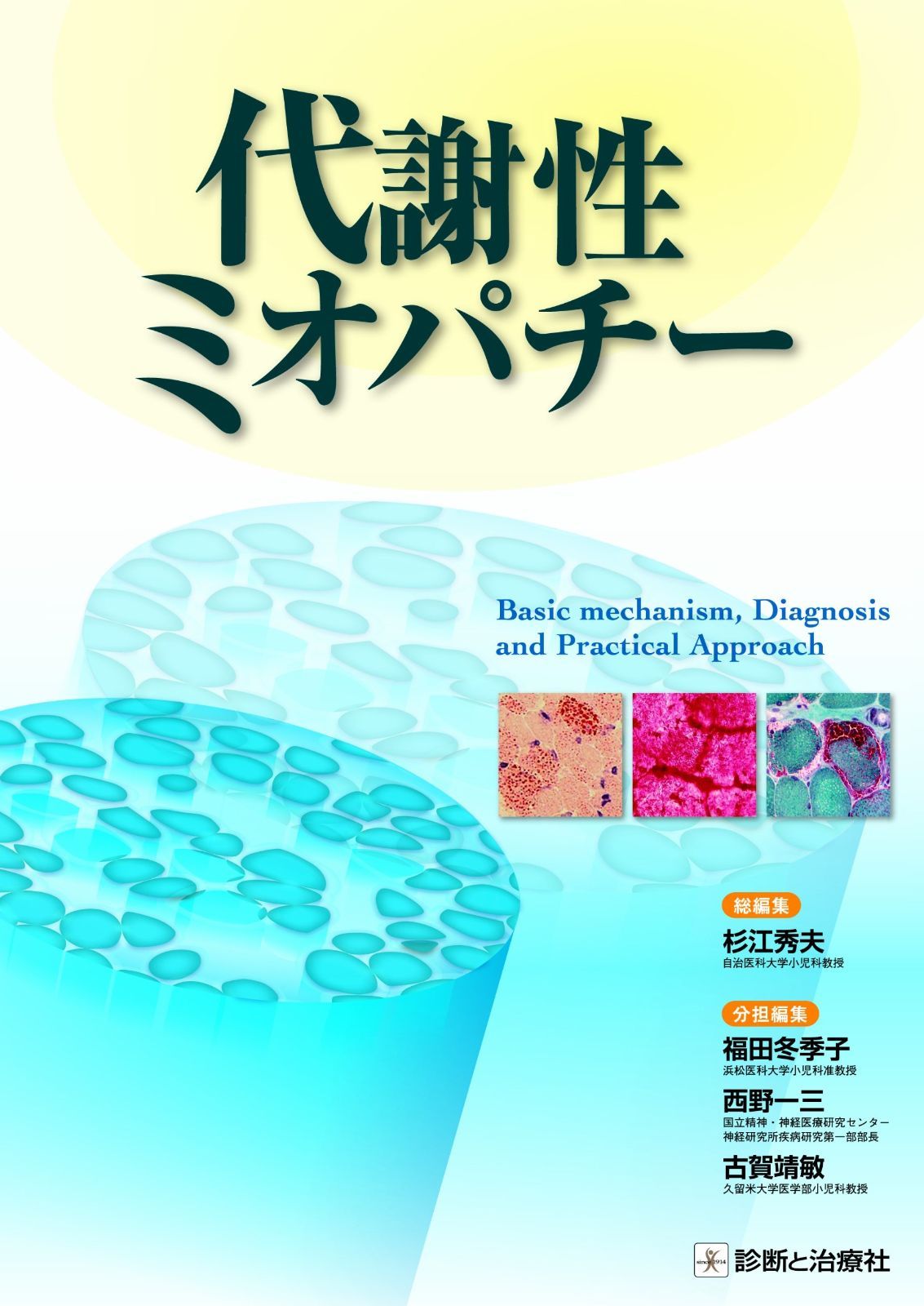 代謝性ミオパチー Basic mechanism%ｶﾝﾏ% Diagnosis and Practical Approach
