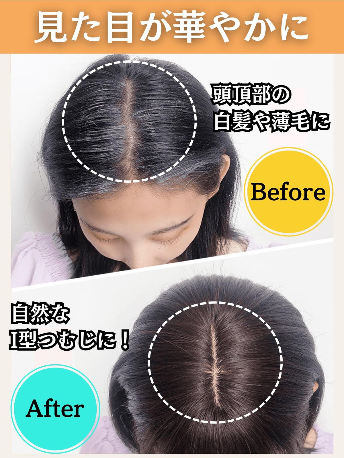 部分ウィッグ 25cm ヘアピース かつら レディース 人毛100% ストレート 分け目 シルク ウィッグ セミロング 医療用 つむじ 頭頂部 カツラ  トップピース 分け目自由自在 ウイッグ うぃっぐ 必需品５点セット 艶髪美人ミディアムpremium - メルカリ