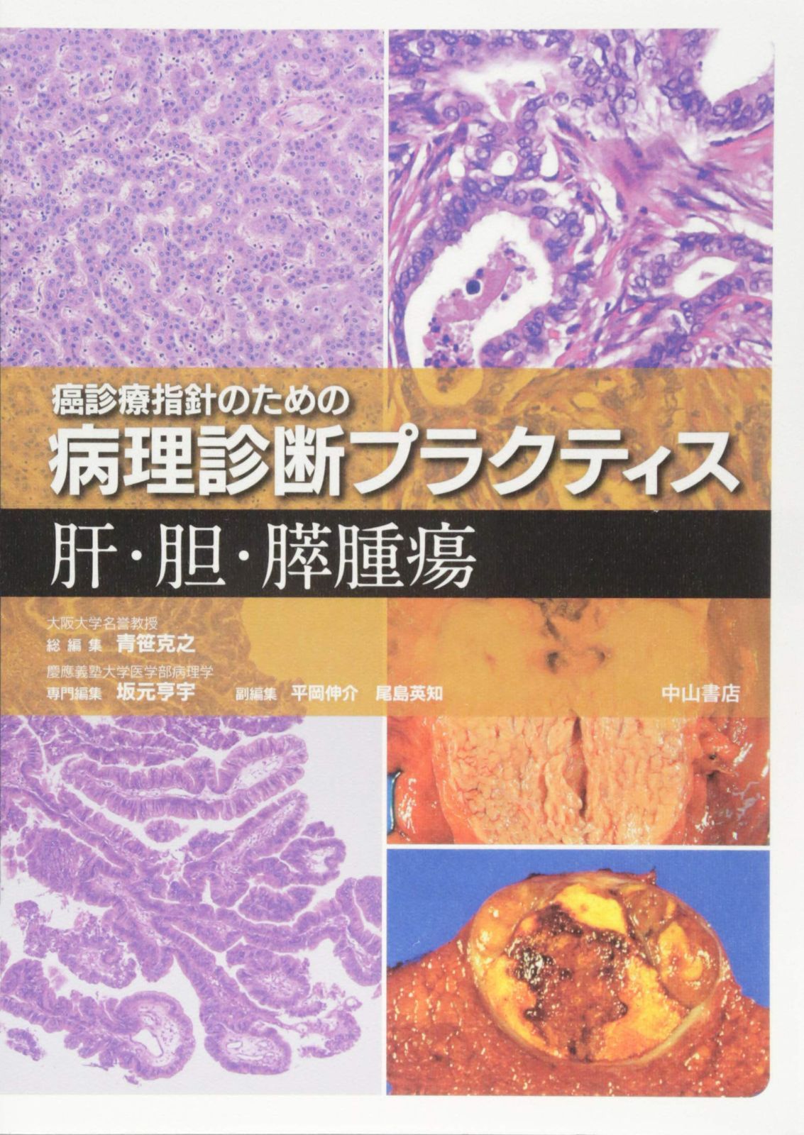 肝・胆・膵腫瘍 (癌診療指針のための病理診断プラクティス)