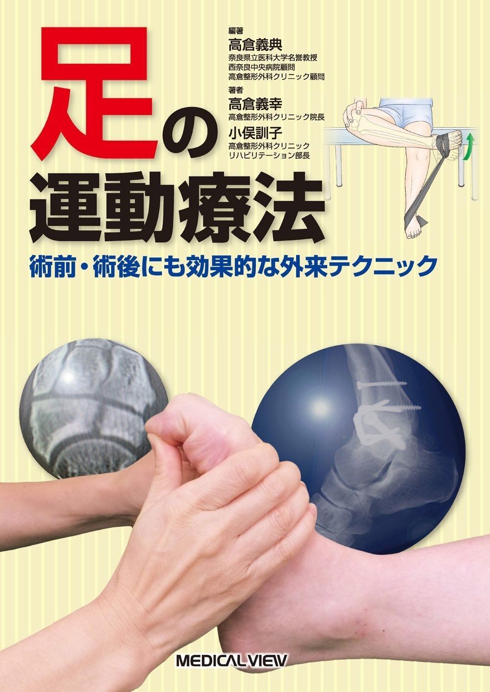 足の運動療法?術前 術後にも効果的な外来テクニック