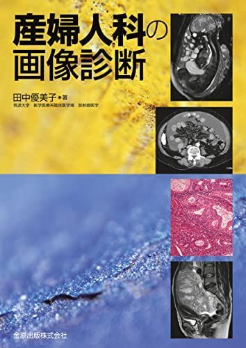 産婦人科の画像診断 / 田中優美子 - 紀伊國屋書店ウェブストア