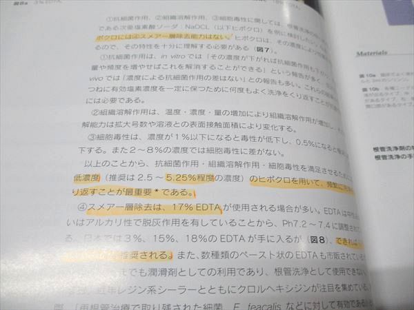 クインテッセンス出版 再根管治療を極める 2011 牛窪敏博 015S3D