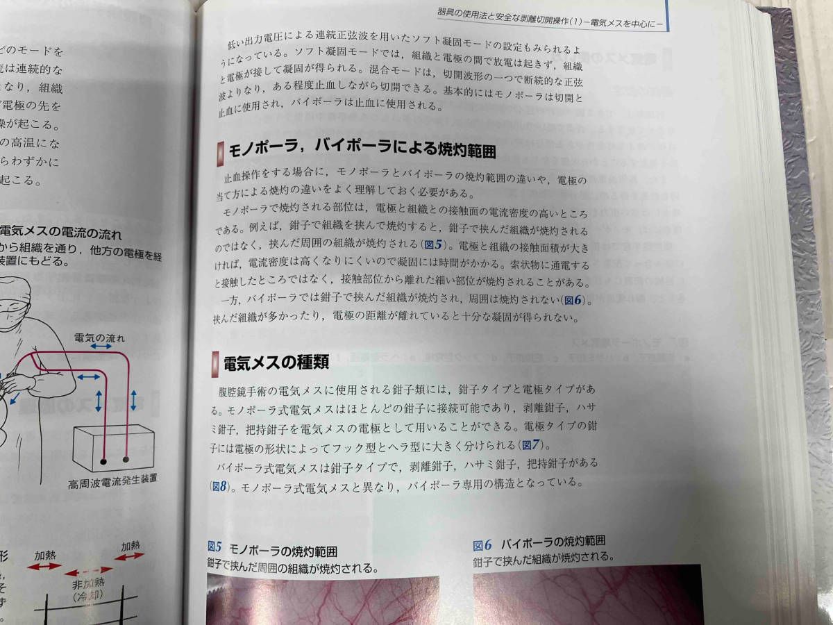 泌尿器腹腔鏡手術 ベーシックテクニック−安全な手術のために