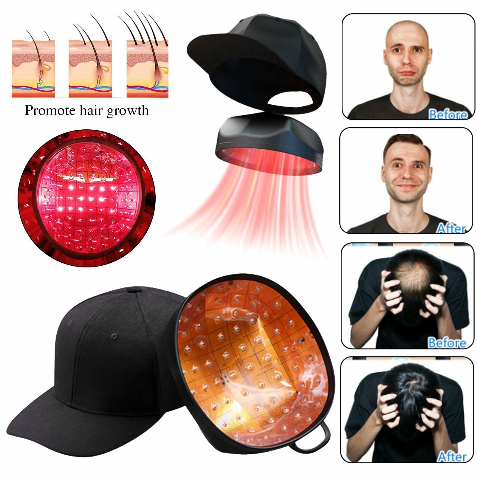 第二世代 LLLT育毛ヘルメット 94 pc 男女兼用 発毛促進 発毛 養毛 脱毛 薄毛 かんたん操作 頭髪ケア スカルプケア 最先端育毛テクノロジー