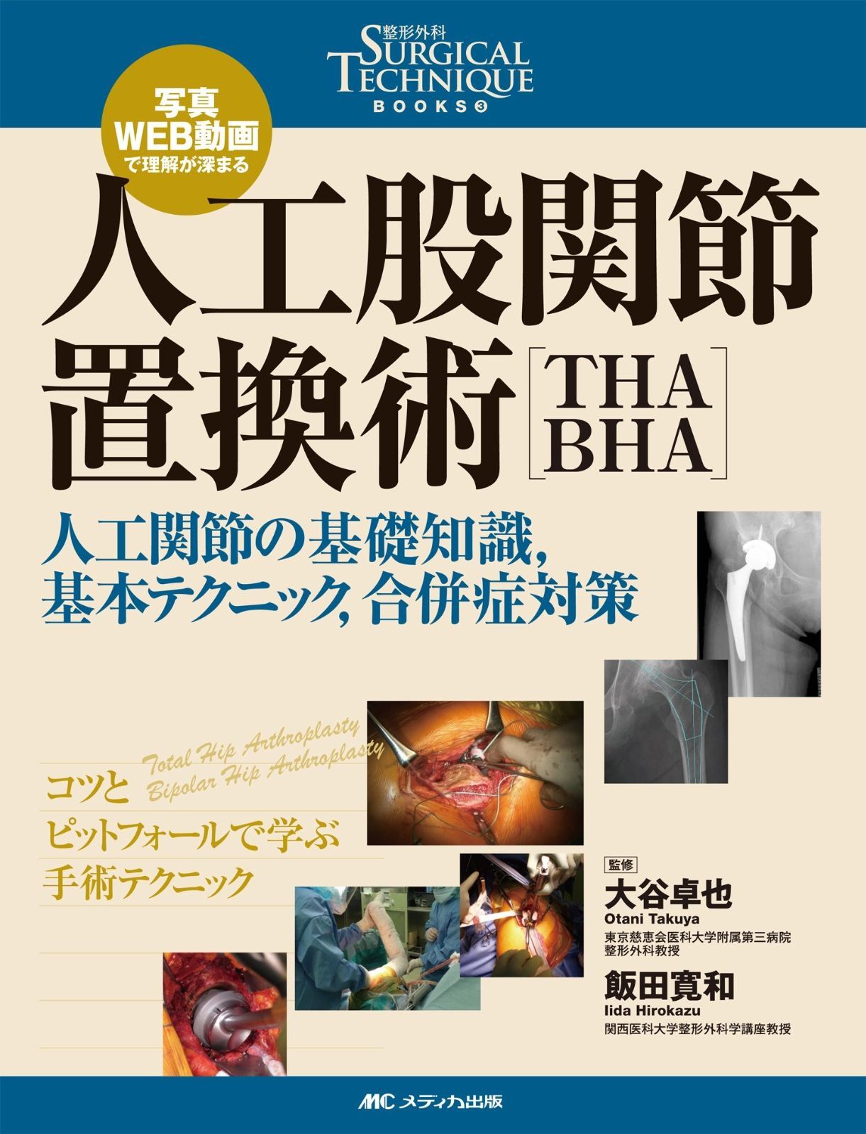 人工股関節置換術[THA・BHA]: 写真・WEB動画で理解が深まる/人工関節の基礎知識%ｶﾝﾏ%基本テクニック%ｶﾝﾏ%合併症対策 (整形外科SURGICAL TECHNIQUE BOOKS)