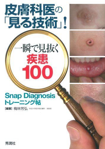 皮膚科医の「見る技術」!一瞬で見抜く疾患100: Snap Diagnosisトレーニング帖 梅林 芳弘