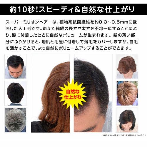 スーパーミリオンヘアー 可愛らしかっ レディース 茶
