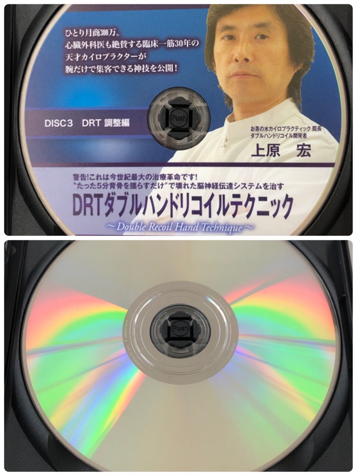 上原宏 DRTダブルハンドリコイルテクニック DVD - 宏 整体 中古DVDDRT