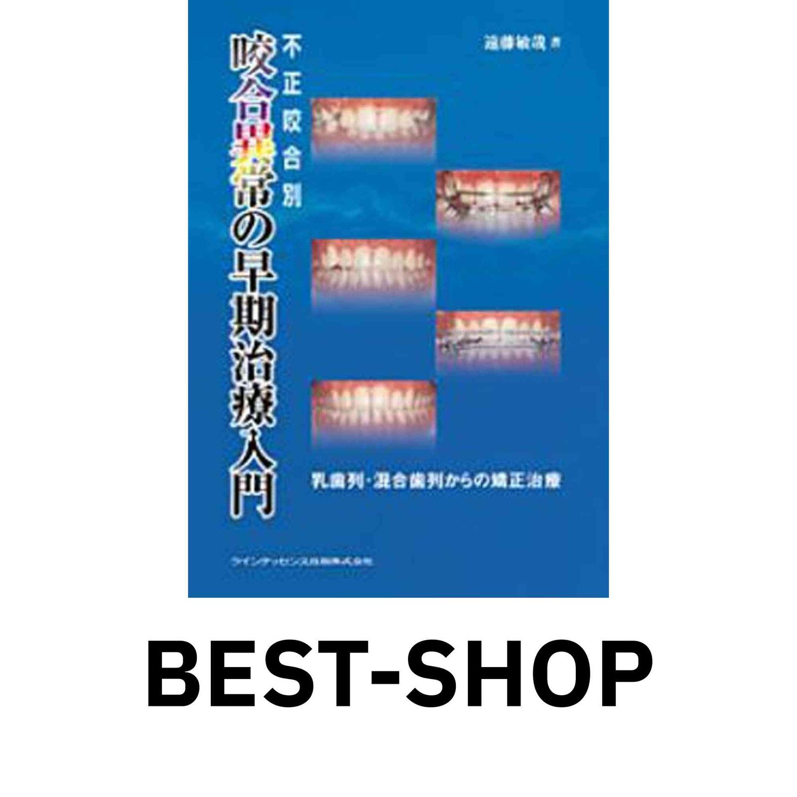 不正咬合別咬合異常の早期治療入門: 乳歯列・混合歯列からの矯正