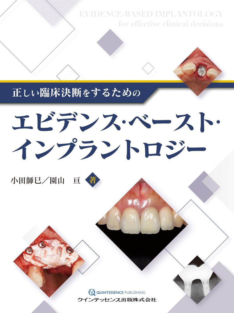 正しい臨床決断をするためのエビデンス・ベースト・インプラントロジー