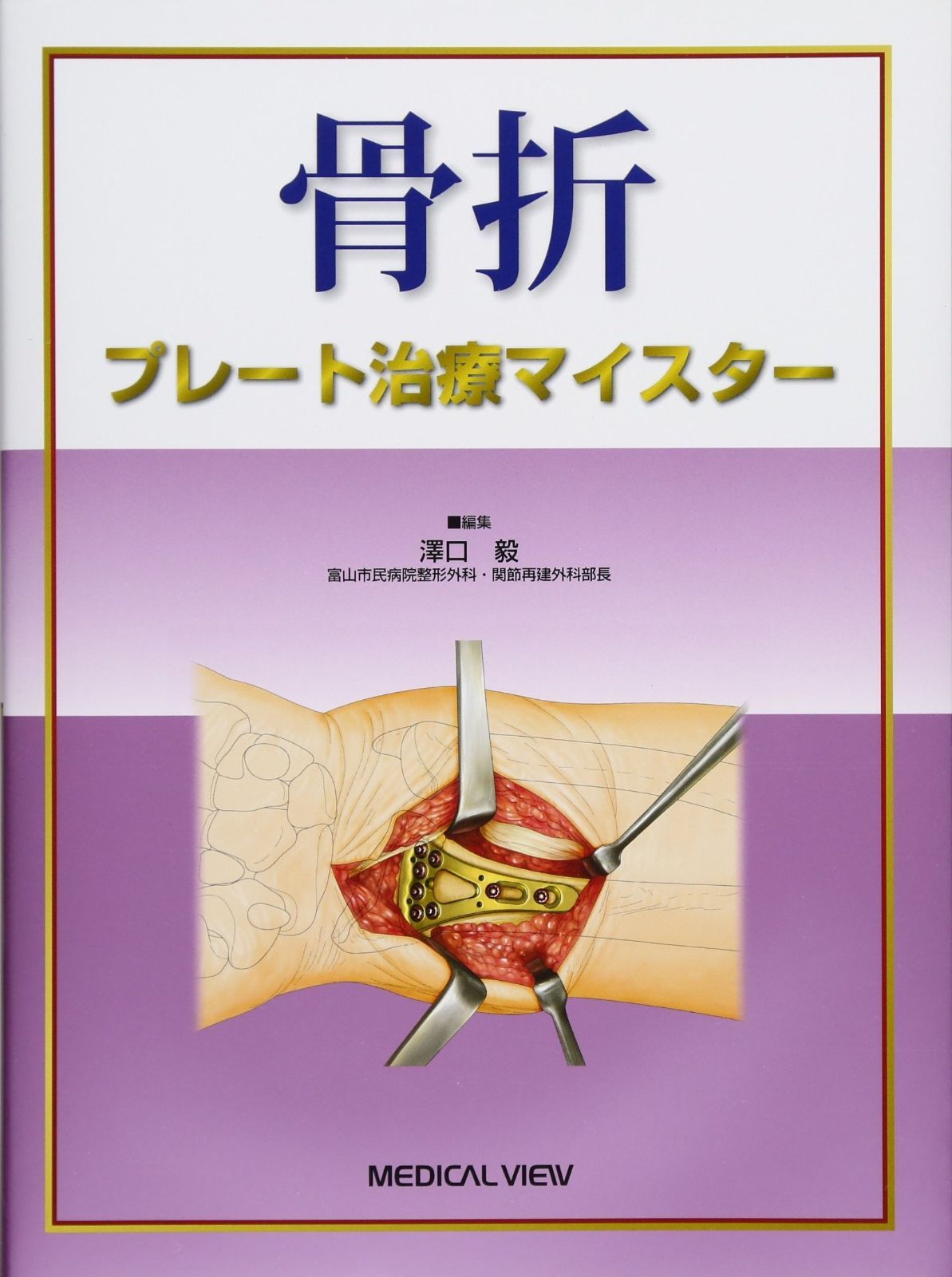 骨折 髄内固定治療マイスター | 澤口 毅 |本 | 通販 | Amazon