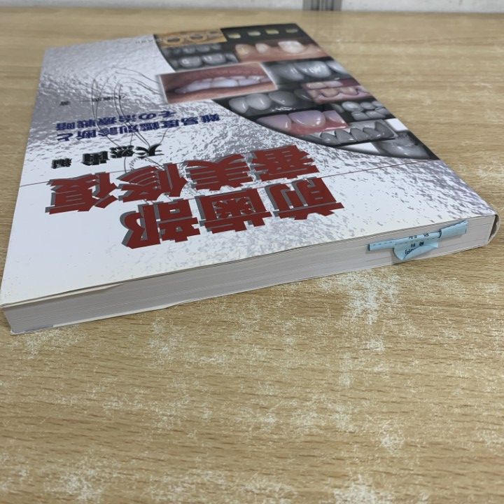 前歯部審美修復 天然歯編 前歯部審美修復 天然歯編 - クインテッセンス出版