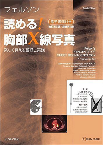 フェルソン 読める!胸部X線写真 改訂第3版/原著第4版 楽しく覚える基礎と実践 フェルソン 読める!胸部X線写真 | 裕満, 大西 フェルソン読めるの通販