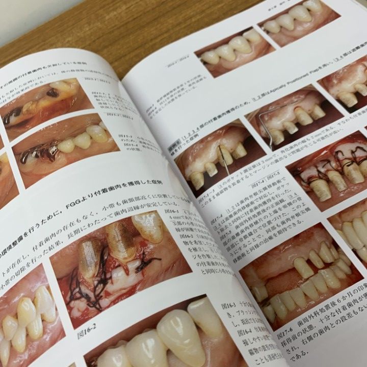 △01)【同梱不可】コンセプトをもった予知性の高い歯周外科処置