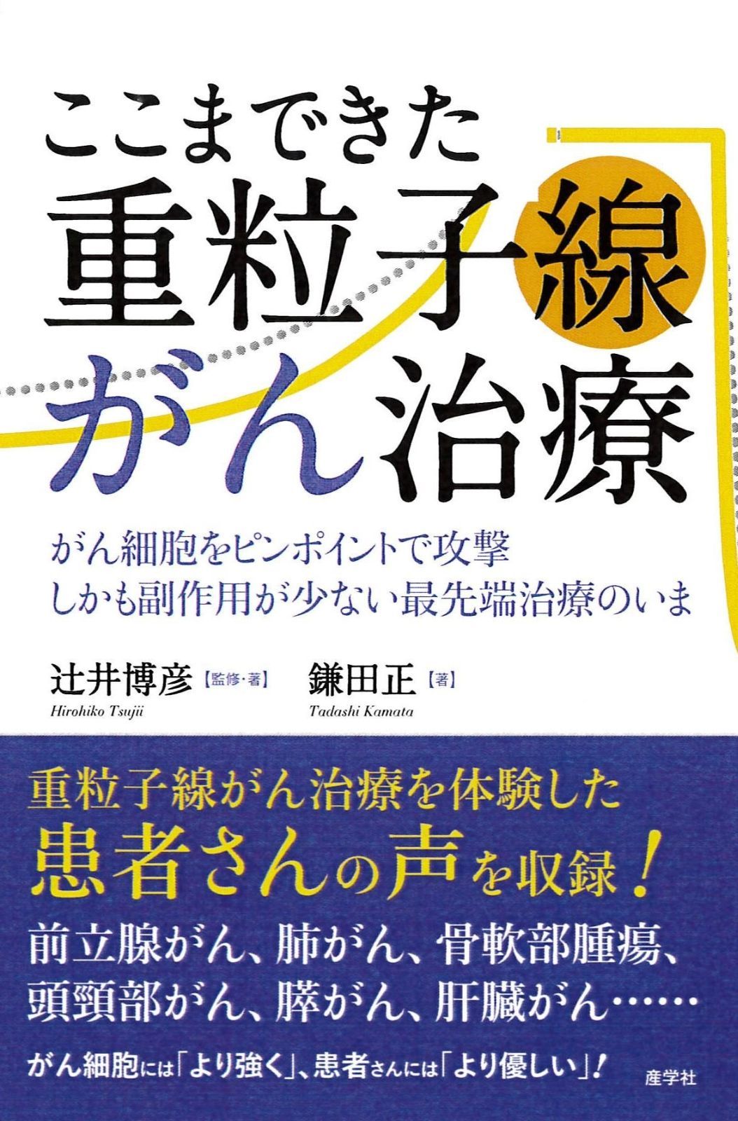 辻井 ここまできた重粒子線がん治療 | 重 対象となるがん 効果の高い新たな技術「マルチイオン」とは ここまできた重粒子線がん治療