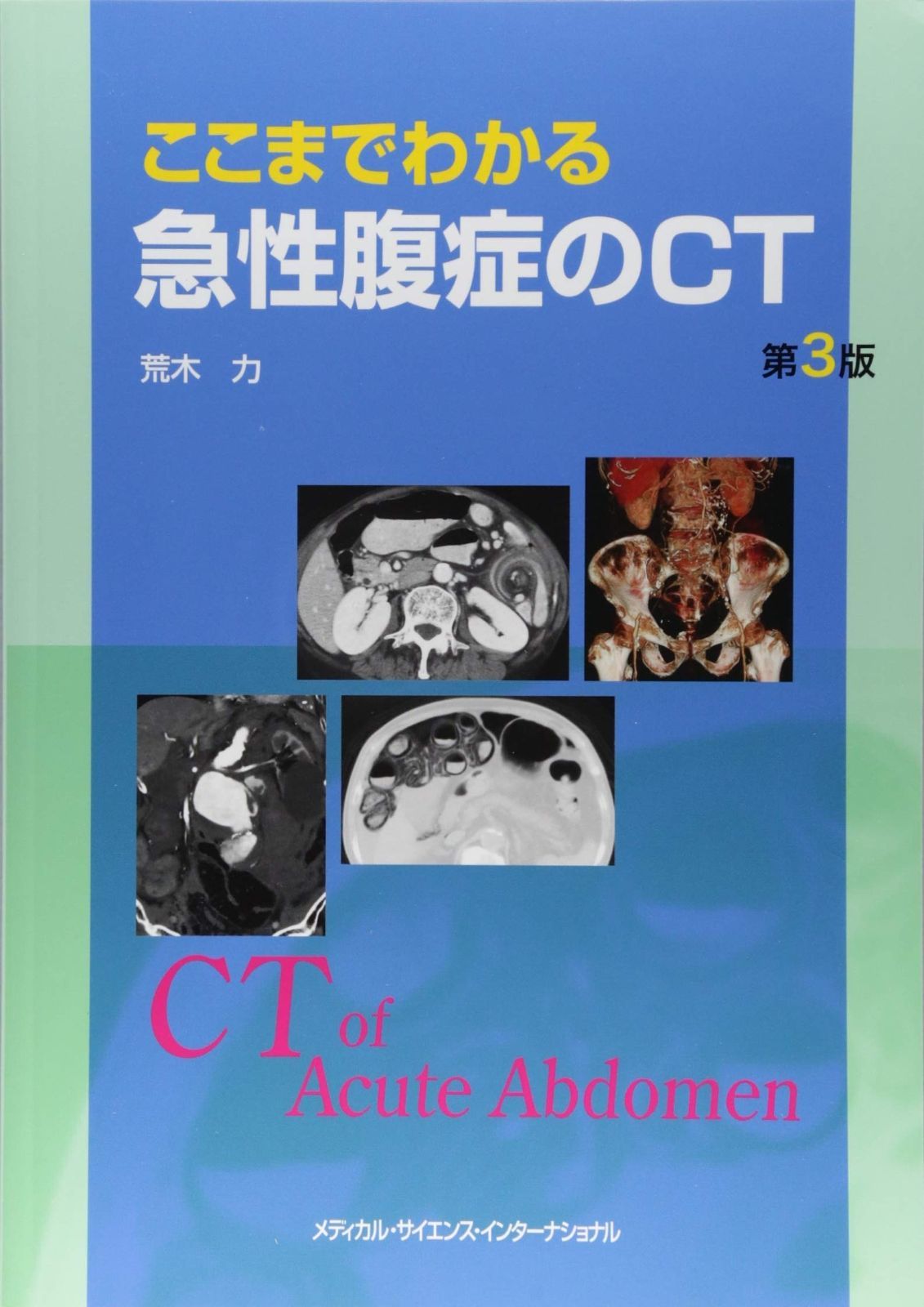 CD (1904) 直筆サイン入り ちいちゃんのかげおくり 読み聞かせ 中井貴惠 CD