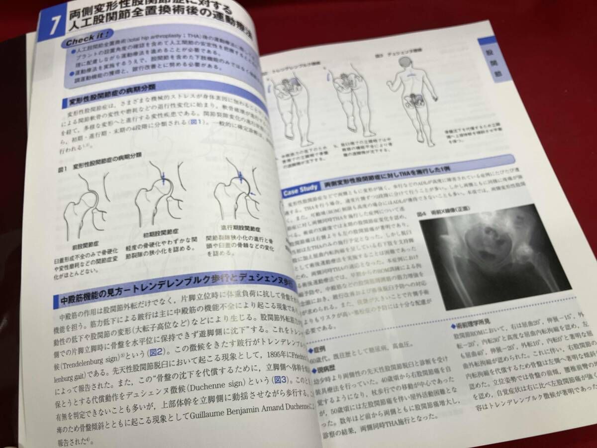 関節機能解剖学に基づく整形外科運動療法ナビゲｰション 整形外科