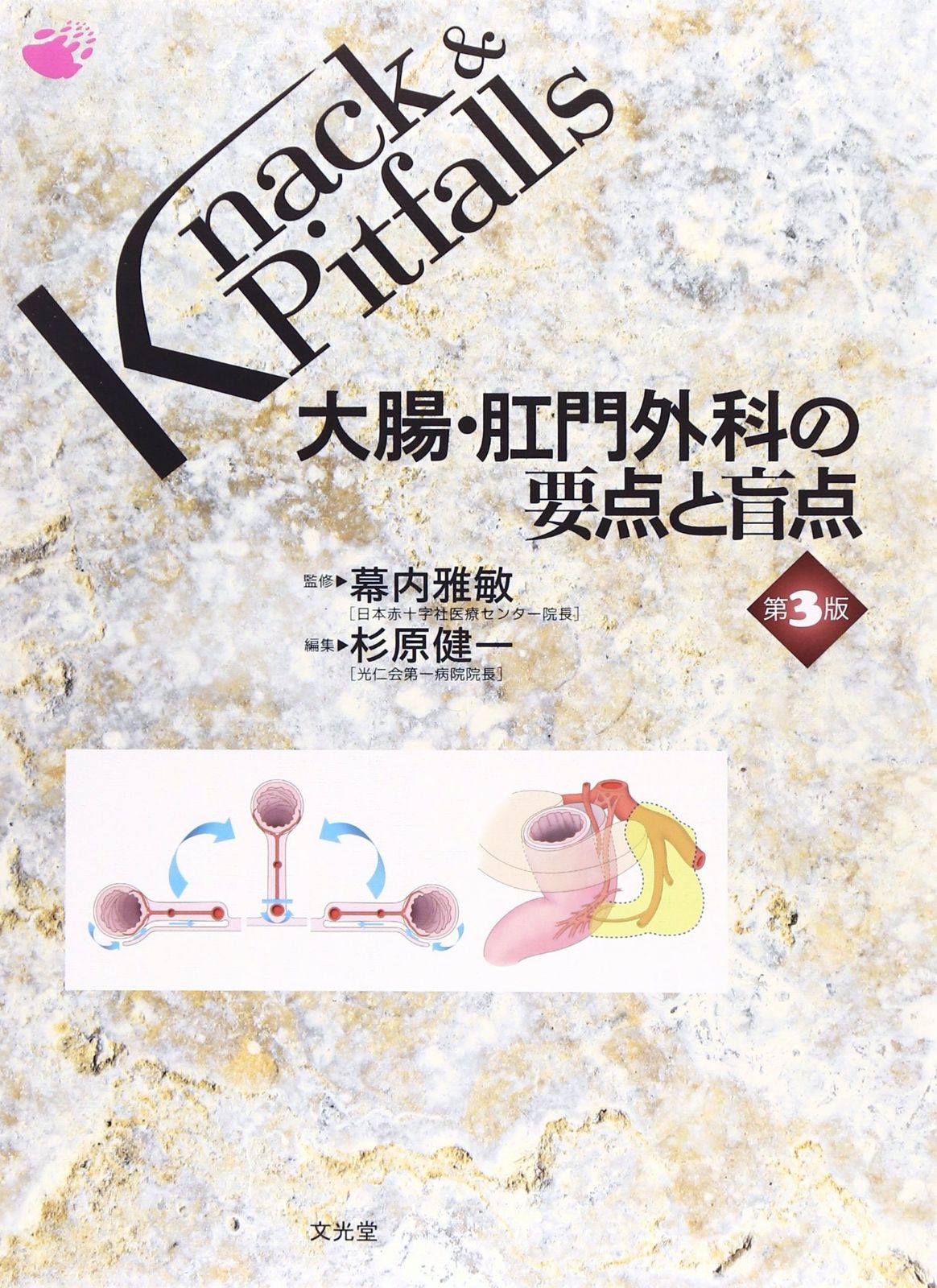 大腸・肛門外科の要点と盲点 第4版 大腸・肛門外科の要点と盲点 第4版 (Knack & Pitfalls) | 杉原