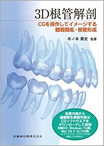 3D根管解剖 CGを操作してイメージする髄腔開拡・根管形成