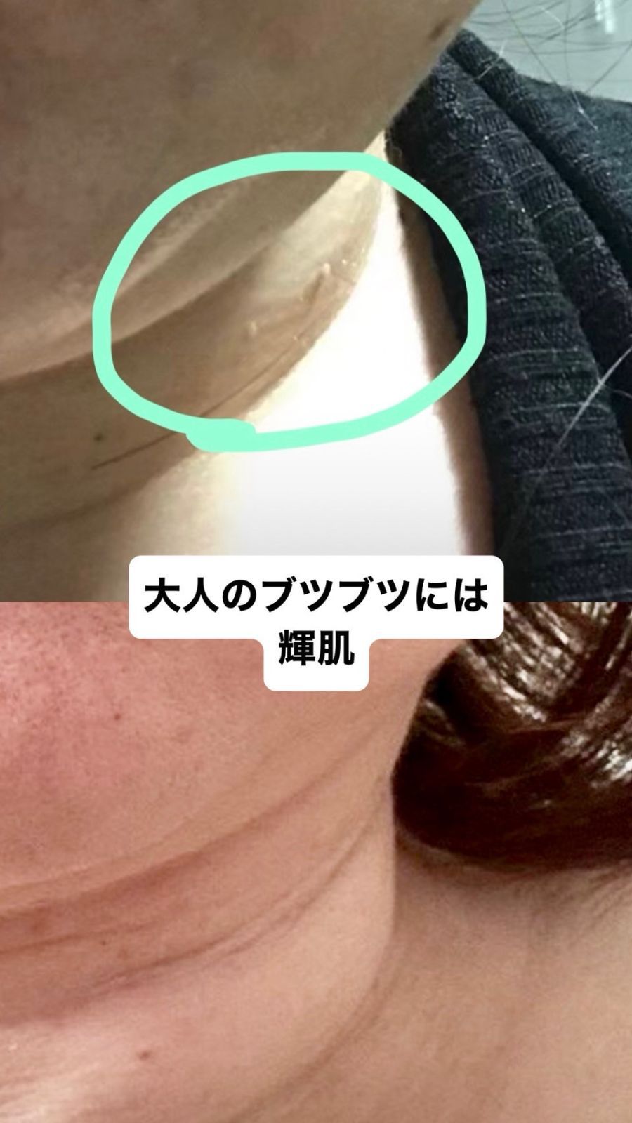 AKINORIO New ミトコンドリアのちから◇アキノリオ◇正規代理店