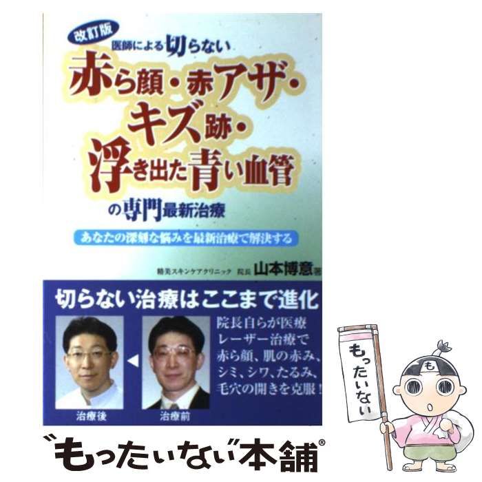 中古】 医師による切らない「赤ら顔・赤アザ・キズ跡・浮き出た