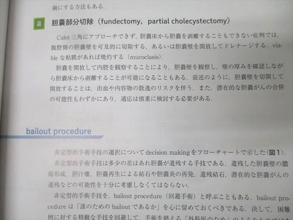 南江堂 ラパコレを究める 技術認定を目指す標準手技・困難例を制すBailout手技 状態良 2020 011m3D 南江堂 ラパコレを究める 技術認定を目指す標準手技・困難例を