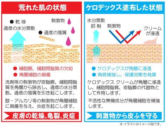 4セット ケロデックスクリーム