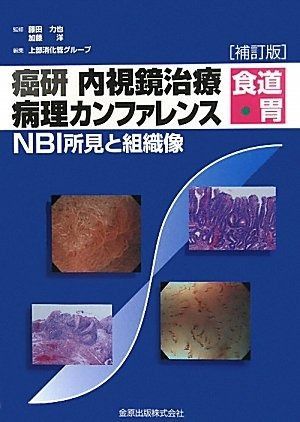人気，SALE 癌研内視鏡治療病理カンファレンス食道・胃: NBI所見と組織像 その他