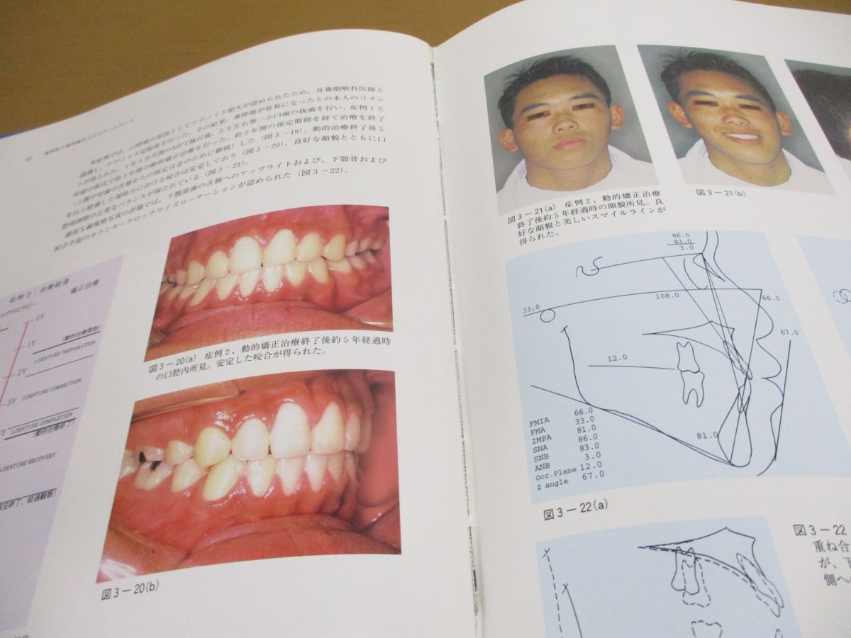 △01)【同梱不可】口腔筋機能療法(MFT)の臨床/山口秀晴/わかば出版 
