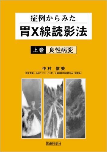 症例からみた胃X線読影法〈上巻〉良性病変 [単行本] 中村 信美 - メルカリ