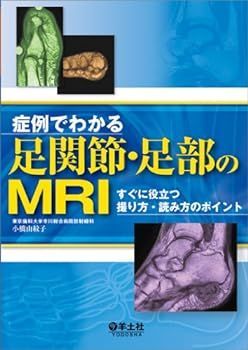【中古】症例でわかる足関節・足部のMRI?すぐに役立つ撮り方・読み方のポイント