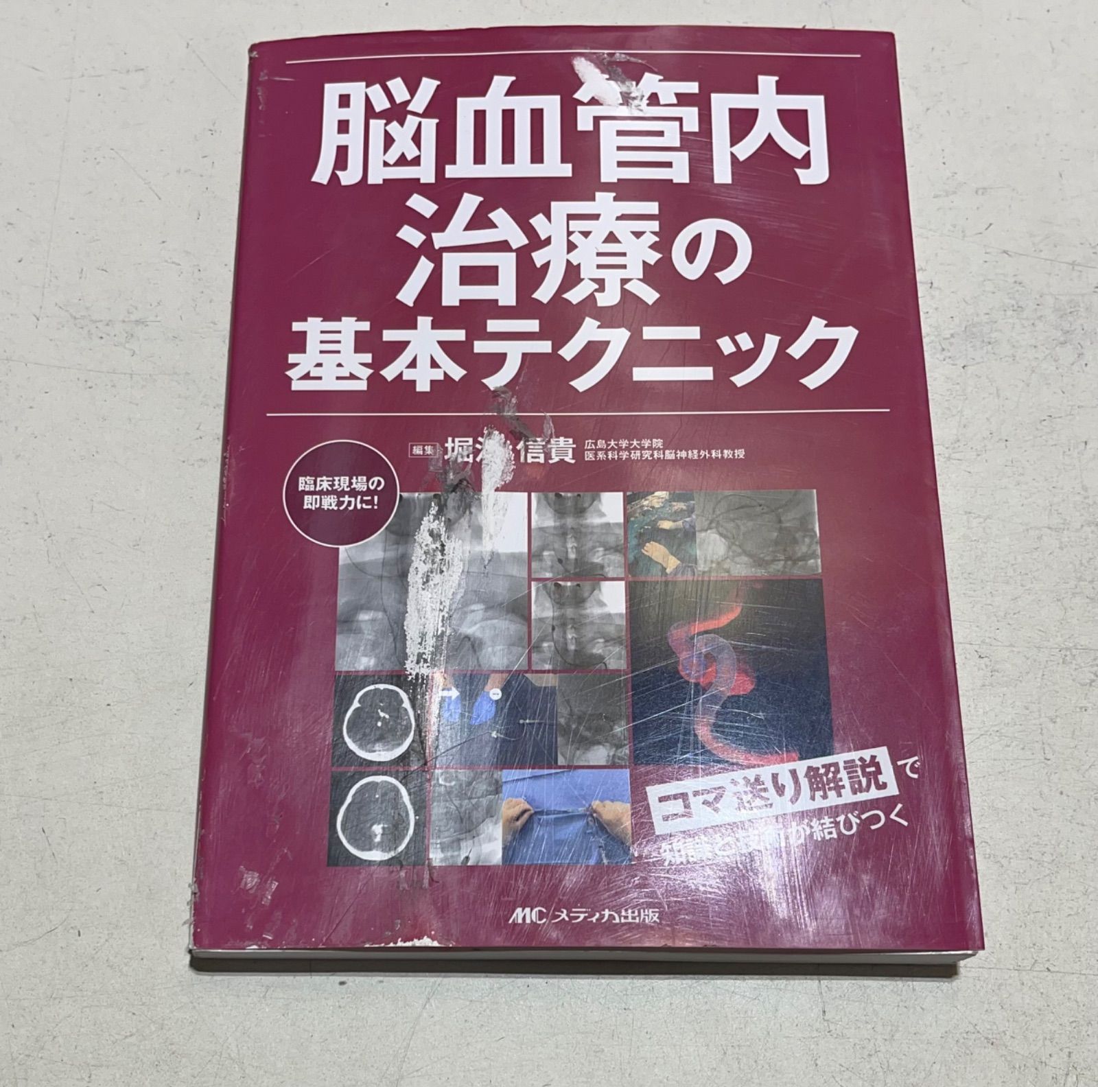 販売 脳血管内治療の基本テクニック - 堀江信貴