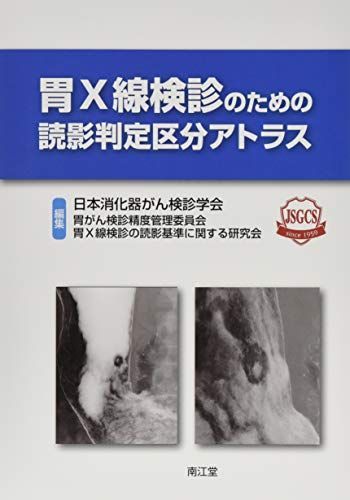 胃X線検診のための読影判定区分アトラス [大型本] 日本消化器がん検診学会胃X線検診の読影基準に関する研究会 - メルカリ