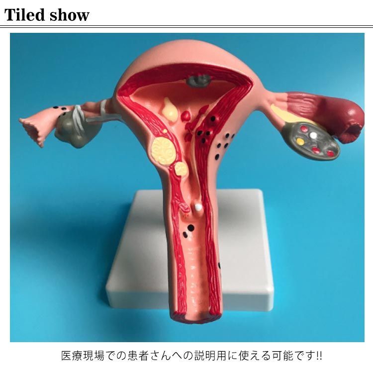 人体模型 女性 生殖器 子宮 膣 卵巣模型 女性生殖器 女性子宮 女性卵巣 模型 子宮モデル 女性生殖器モデル 卵巣モデル人体モデル 標本 教材 実験  人体#qz2313 - メルカリ