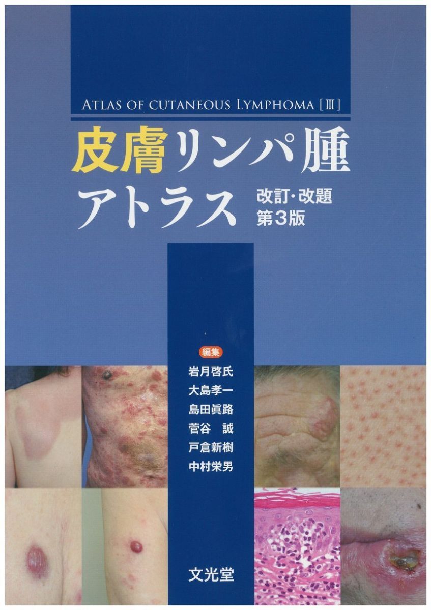 皮膚リンパ腫アトラス 【公式通販】